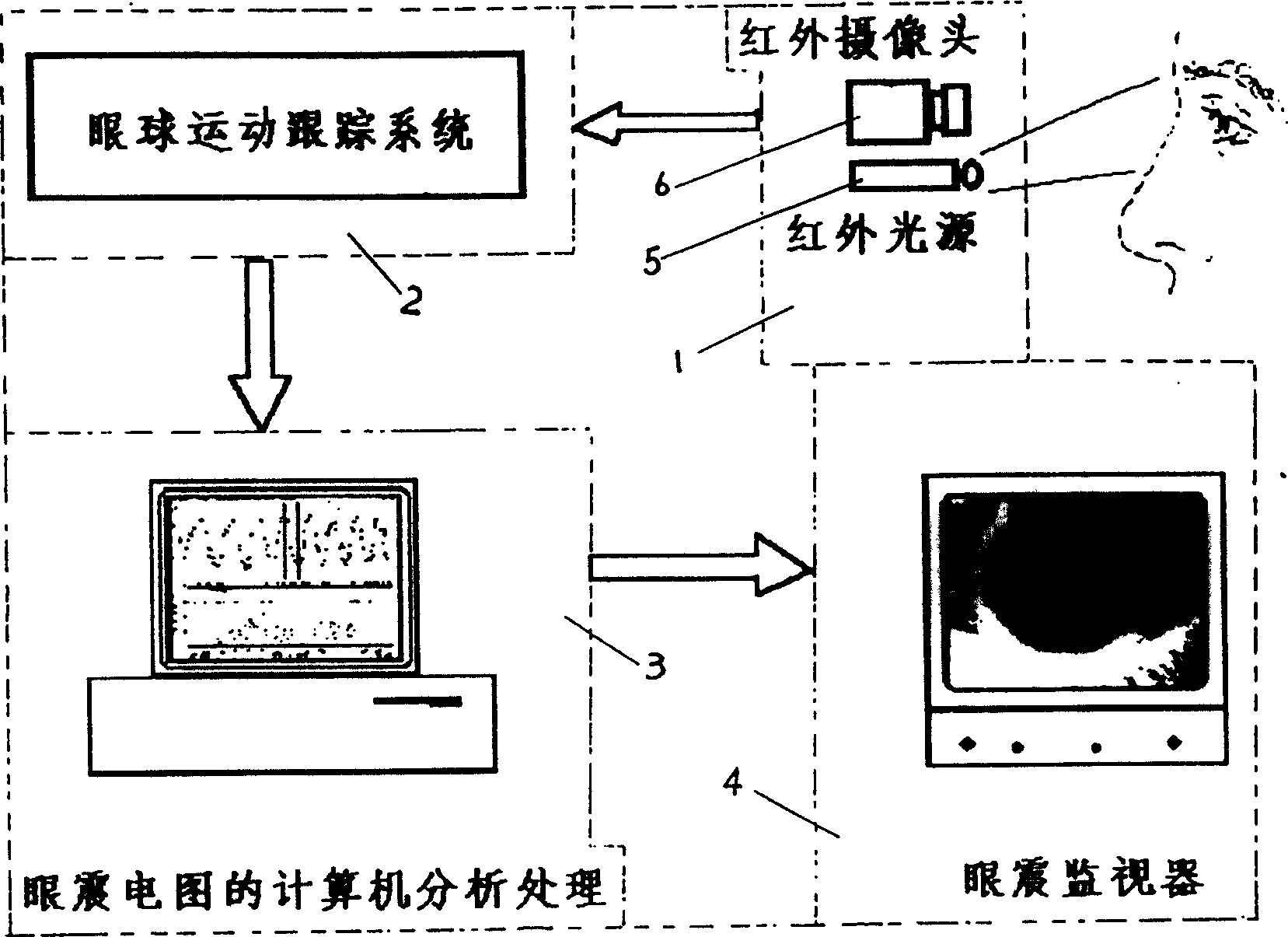 Video frequency electronystagmograph instrument and automatic generation method of video frequency electronystagmograph