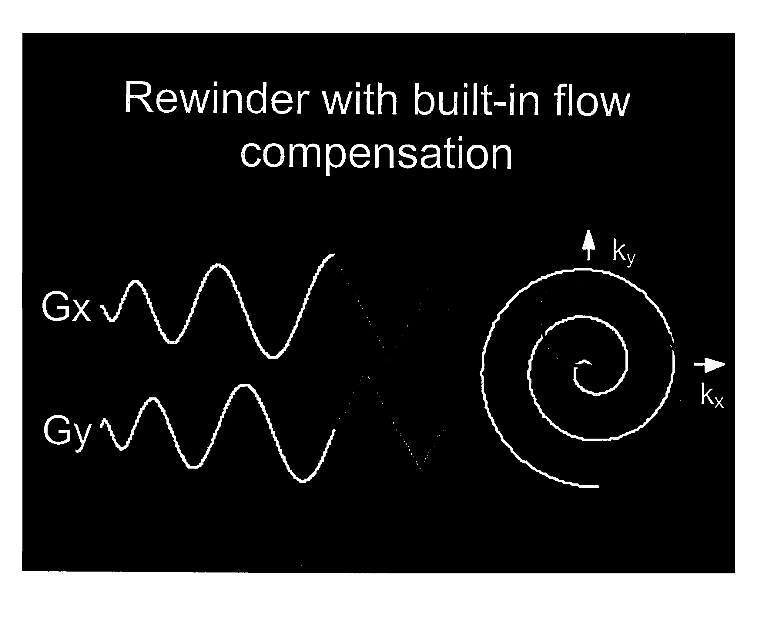 Motion compensated spiral FISP MRI