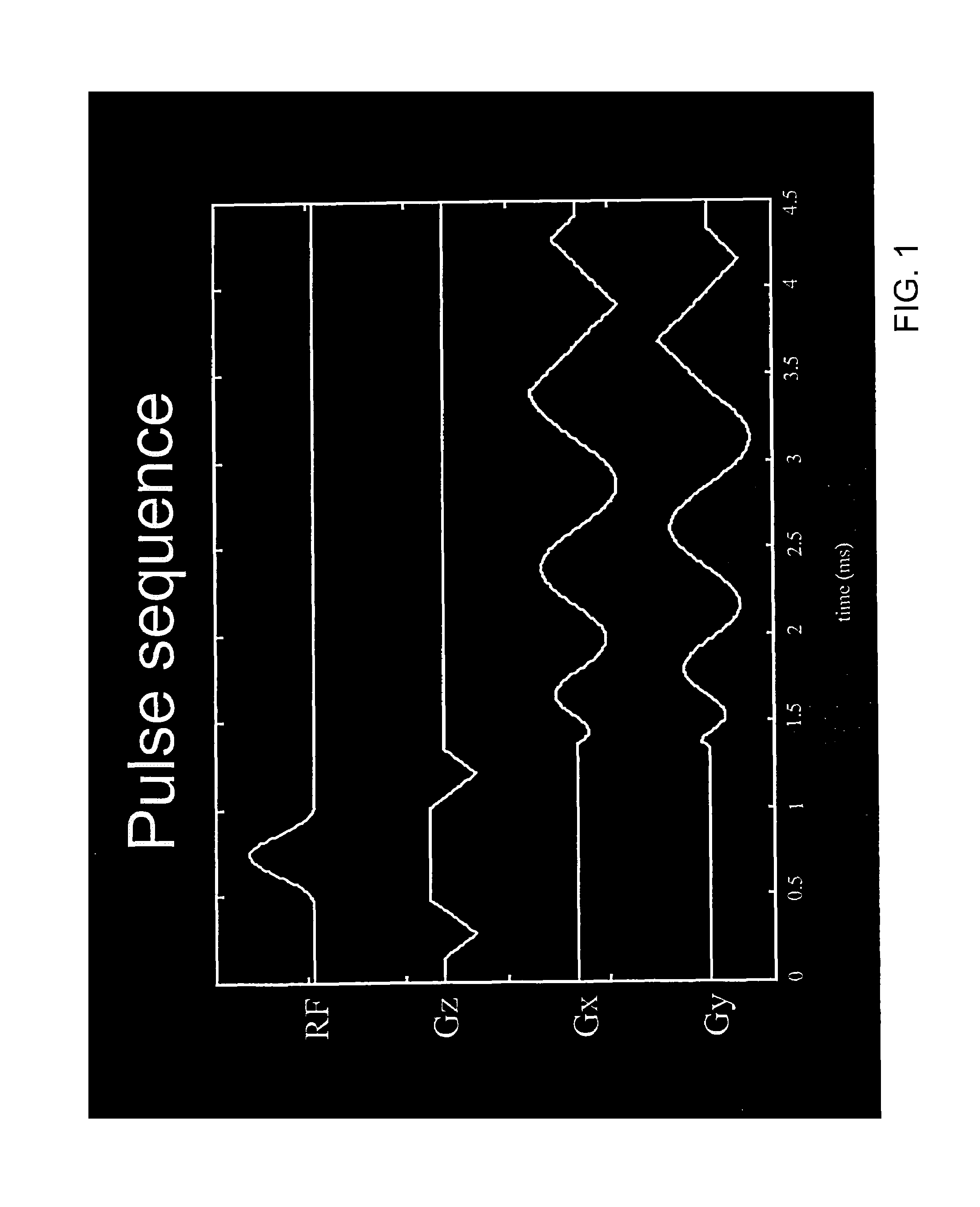 Motion compensated spiral FISP MRI