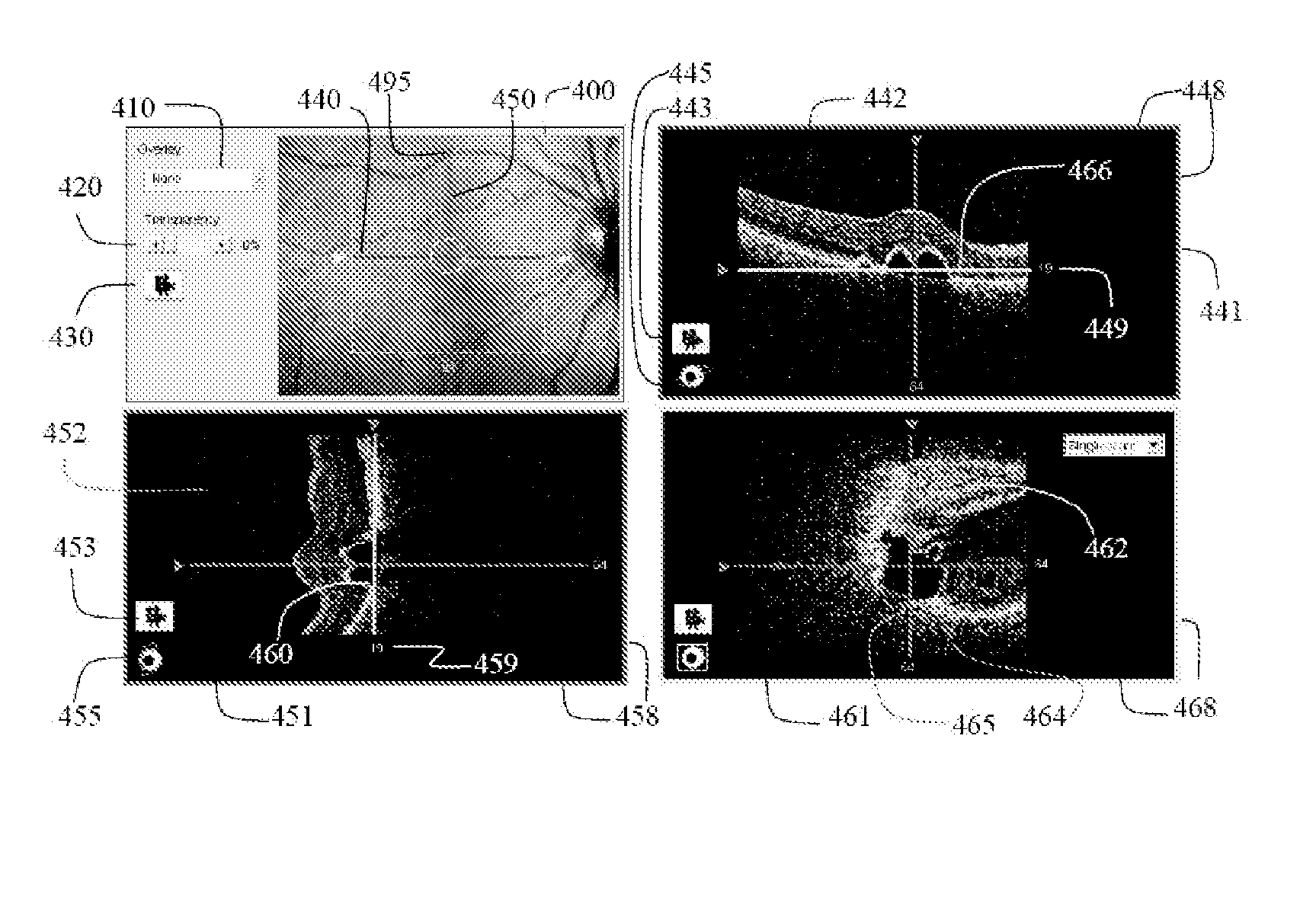 User interface for efficiently displaying relevant OCT imaging data