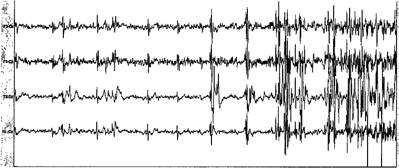 Rhesus monkey temporal lobe epilepsy kindling model and drug screening method thereof