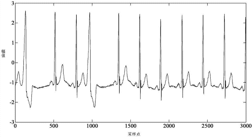 Electrocardiosignal automatic noise reduction method