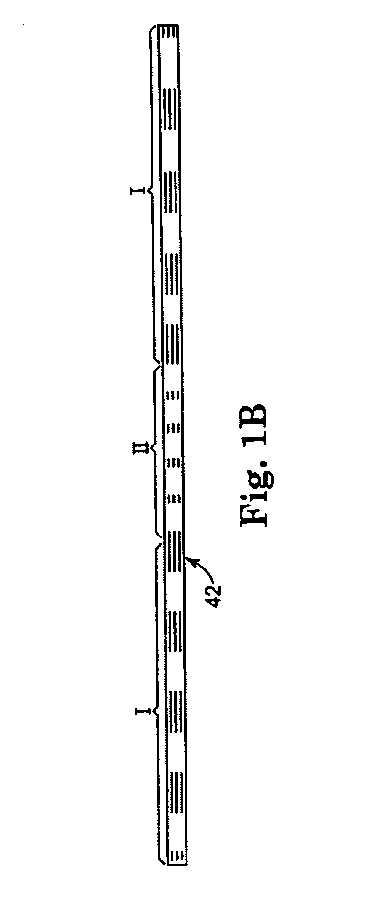 Implantable article and method for treating urinary incontinence using means for repositioning the implantable article