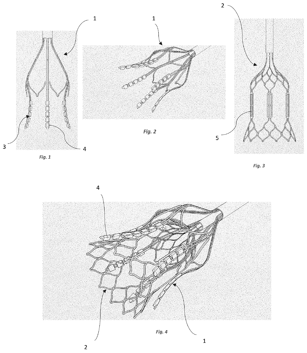 Device for the Treatment of Tissue Calcification