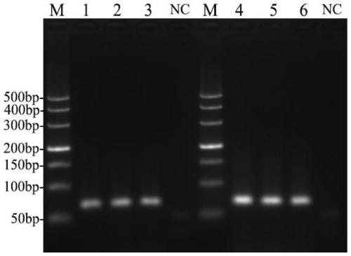 Fluorescent quantitative PCR detection primer group and kit for enterocytozoon hepatopenaei based on TaqMan-MGB probe