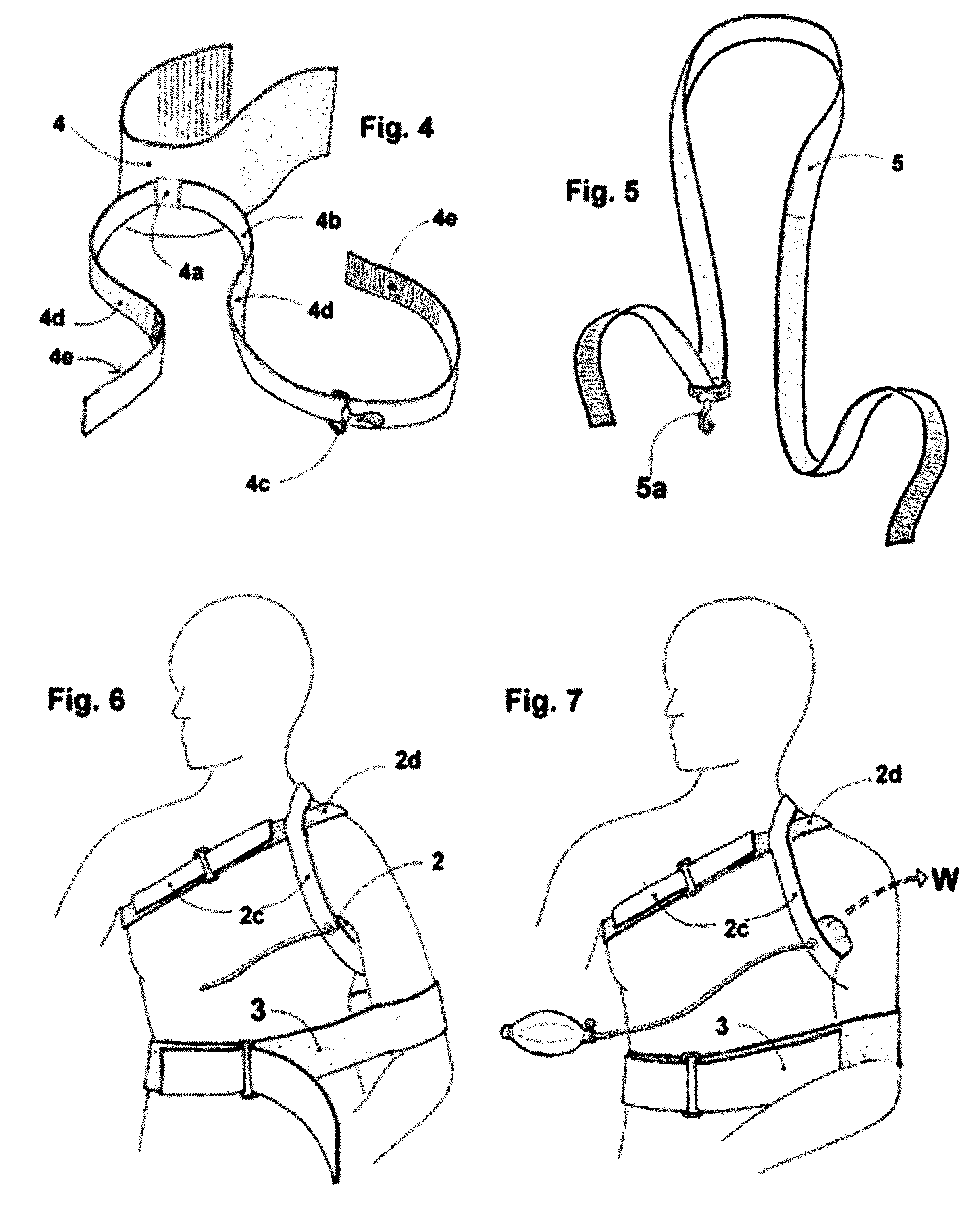 An orthopedic appliance and method to reduce anterior dislocation of shoulder and to provide post reduction immobilization
