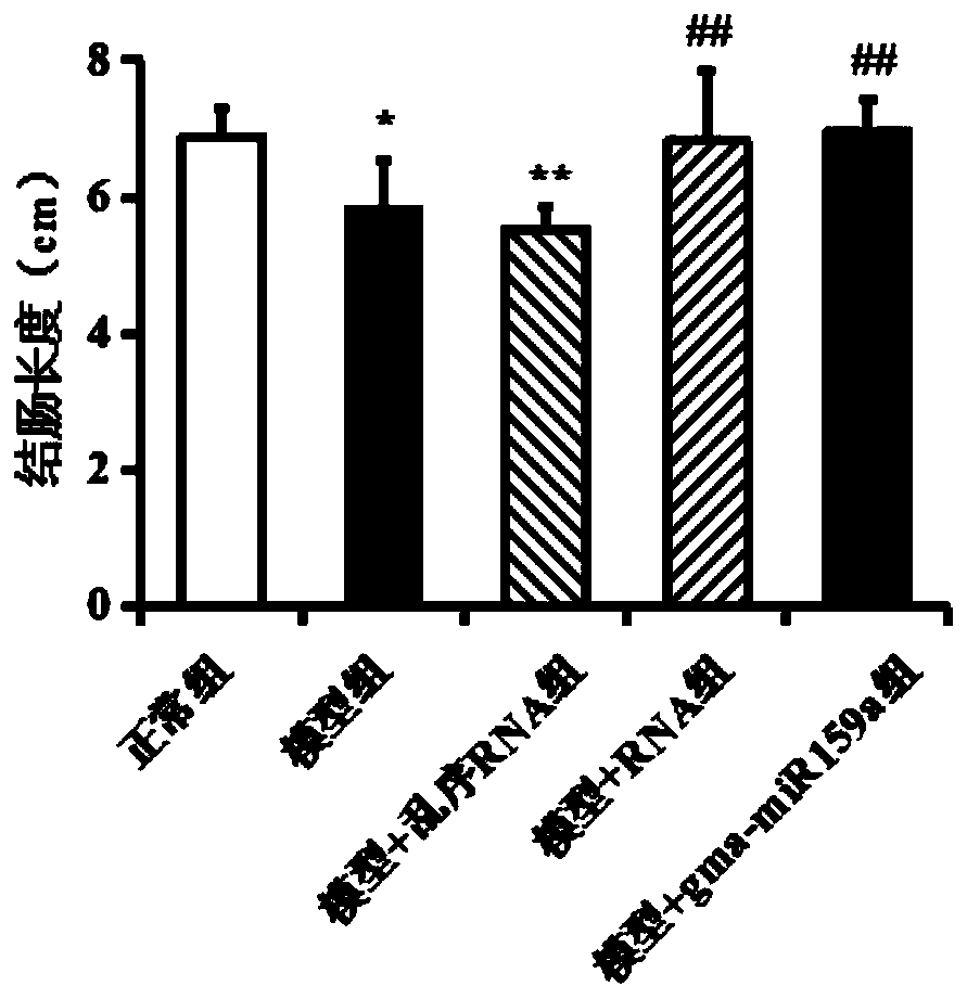 Application of soybean RNA extract in preparation of medicine for preventing and treating enteritis