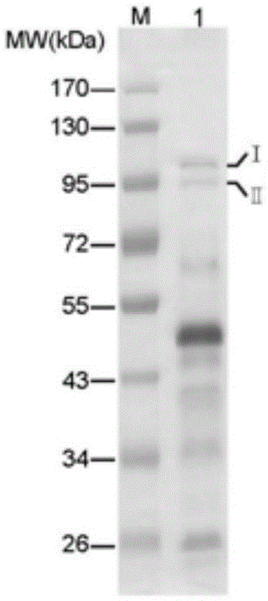 A Zymographic Method for Screening Microbial Extracellular Collagenase