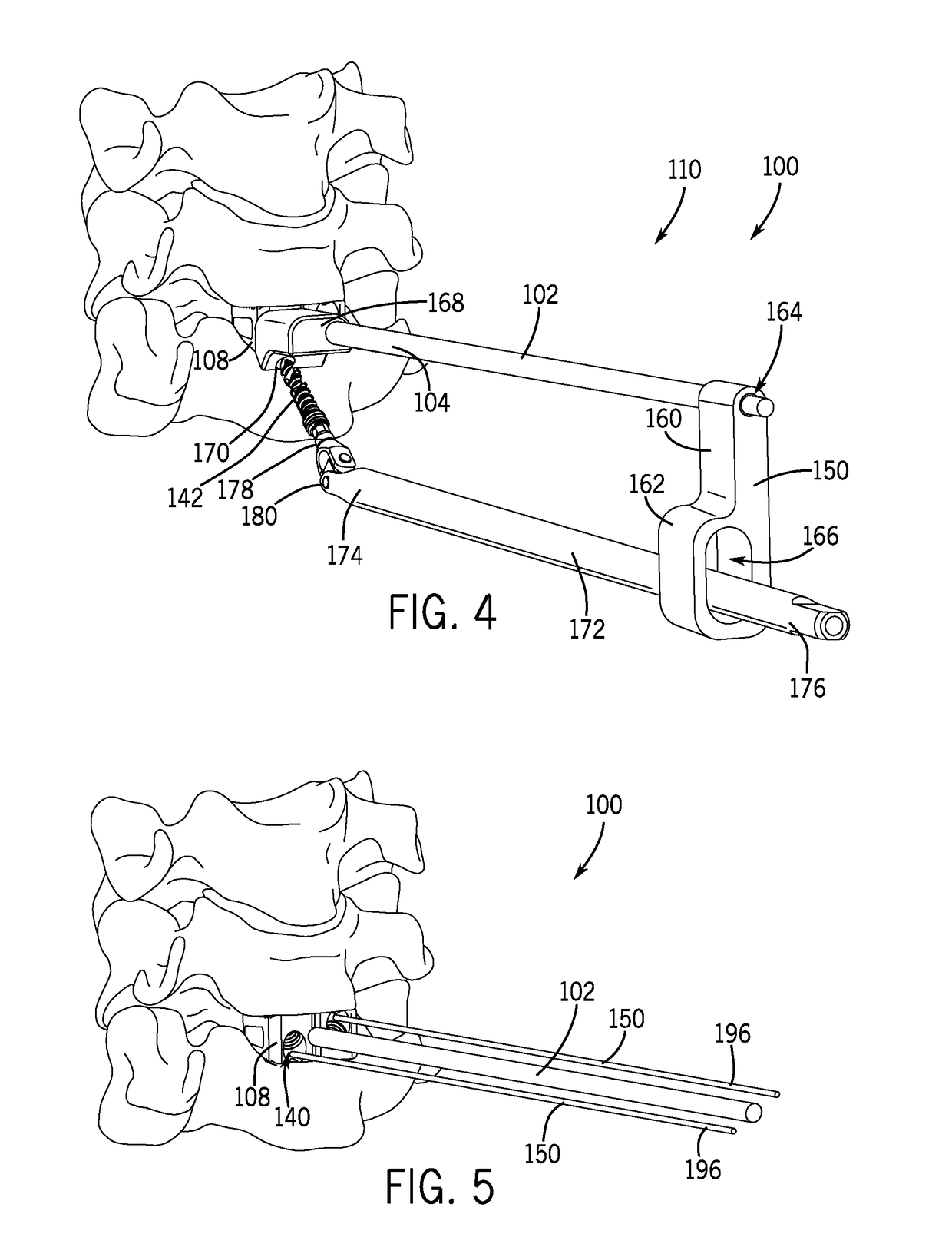 Spinal joint implant delivery device and system
