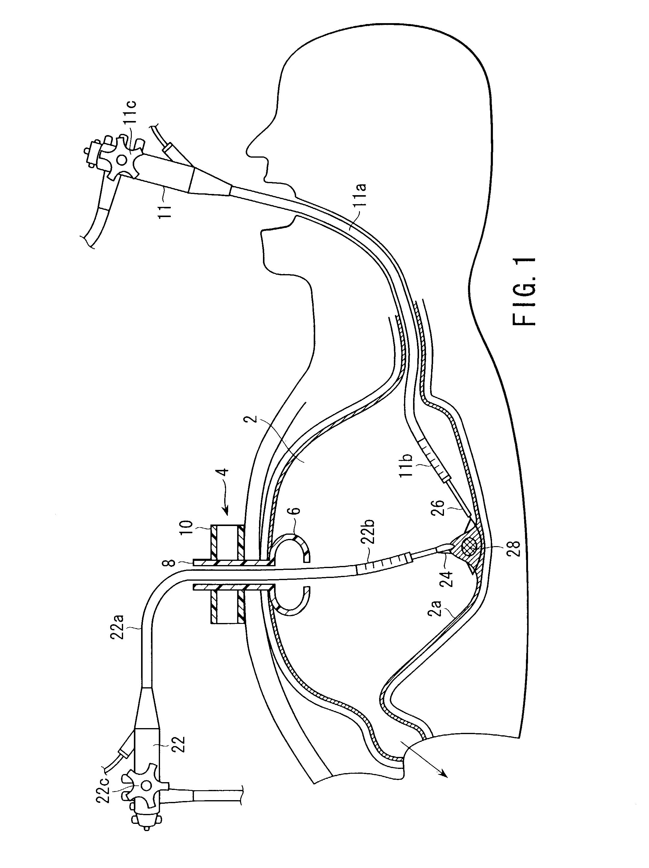 Medical treatment method and apparatus