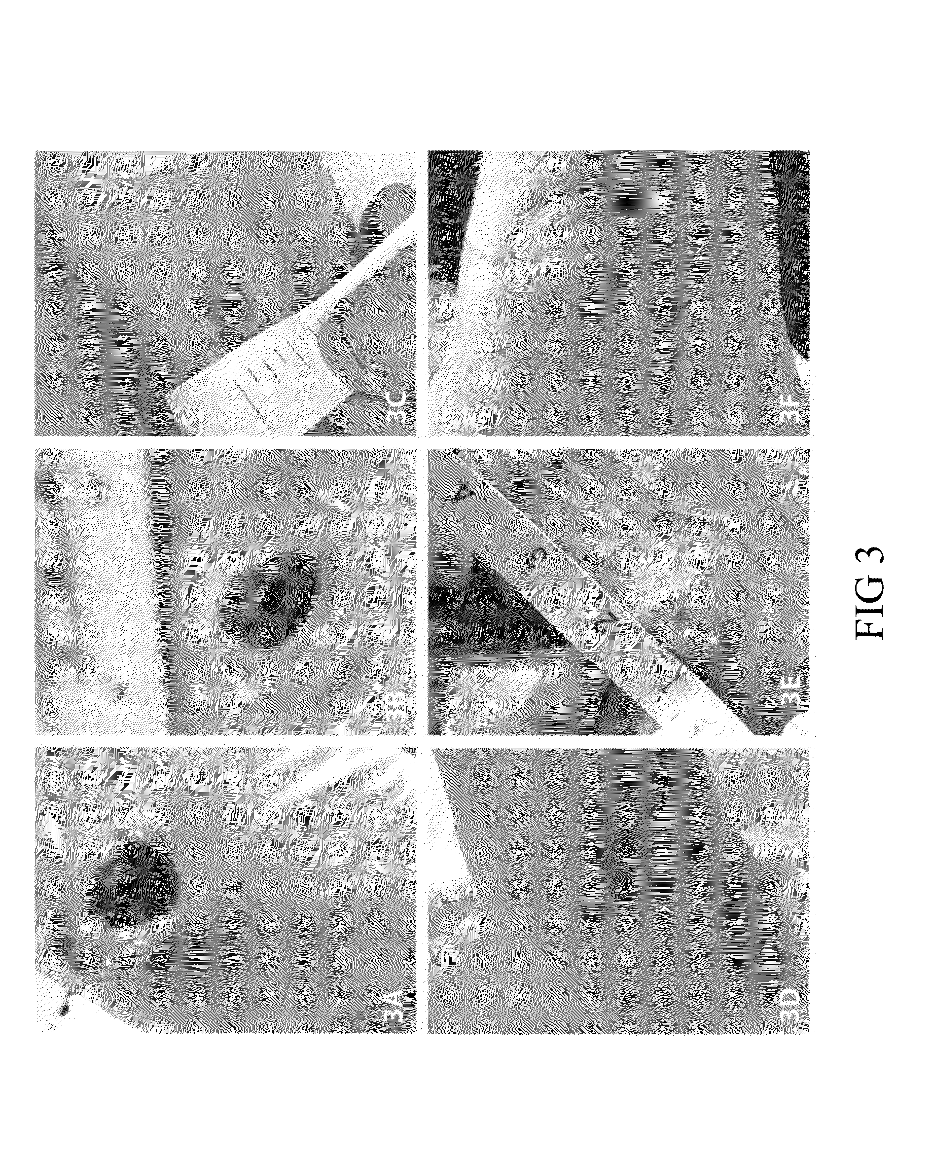 Wound Healing Compositions Involving Medicinal Honey, Mineral ions, and Methylglyoxal, and Methods of Use