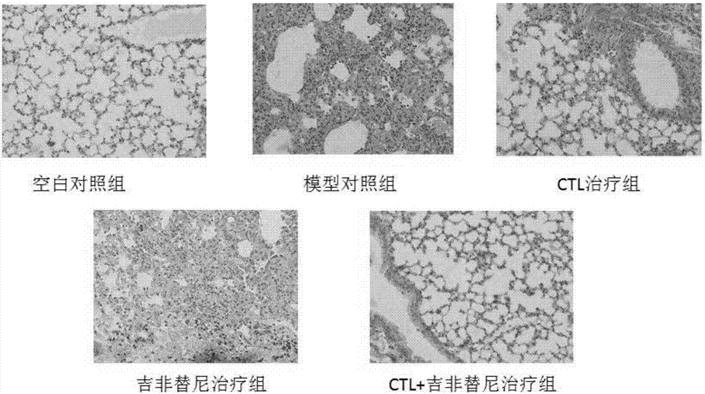 Antigen peptide T790M-1 and application to preparation of medicines for treating non-small cell lung cancer thereof