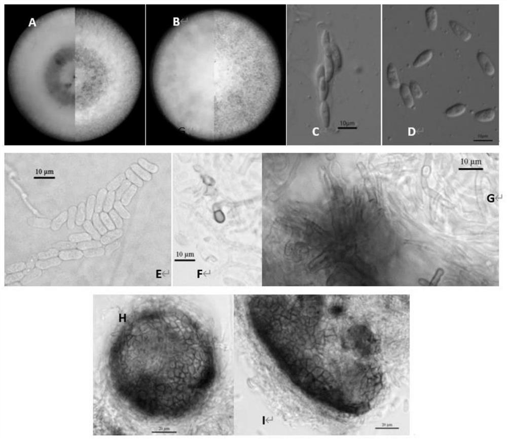 Antimicrobial-resistant strain hcghnqz1736 of Hevea anthracnose and its application in the study of drug resistance