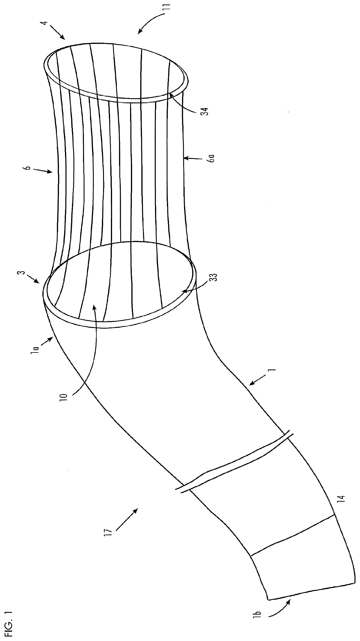 Gastrointestinal implant and positioning apparatus therefor