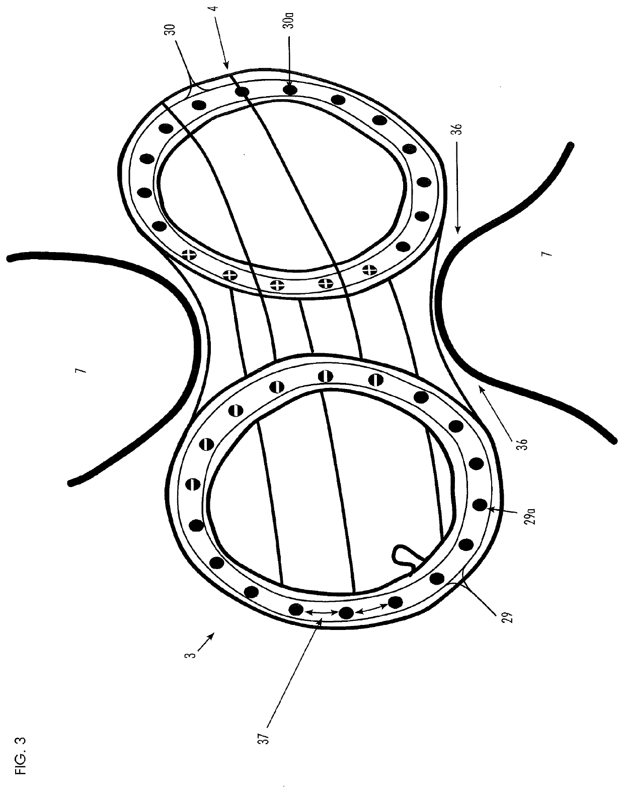 Gastrointestinal implant and positioning apparatus therefor