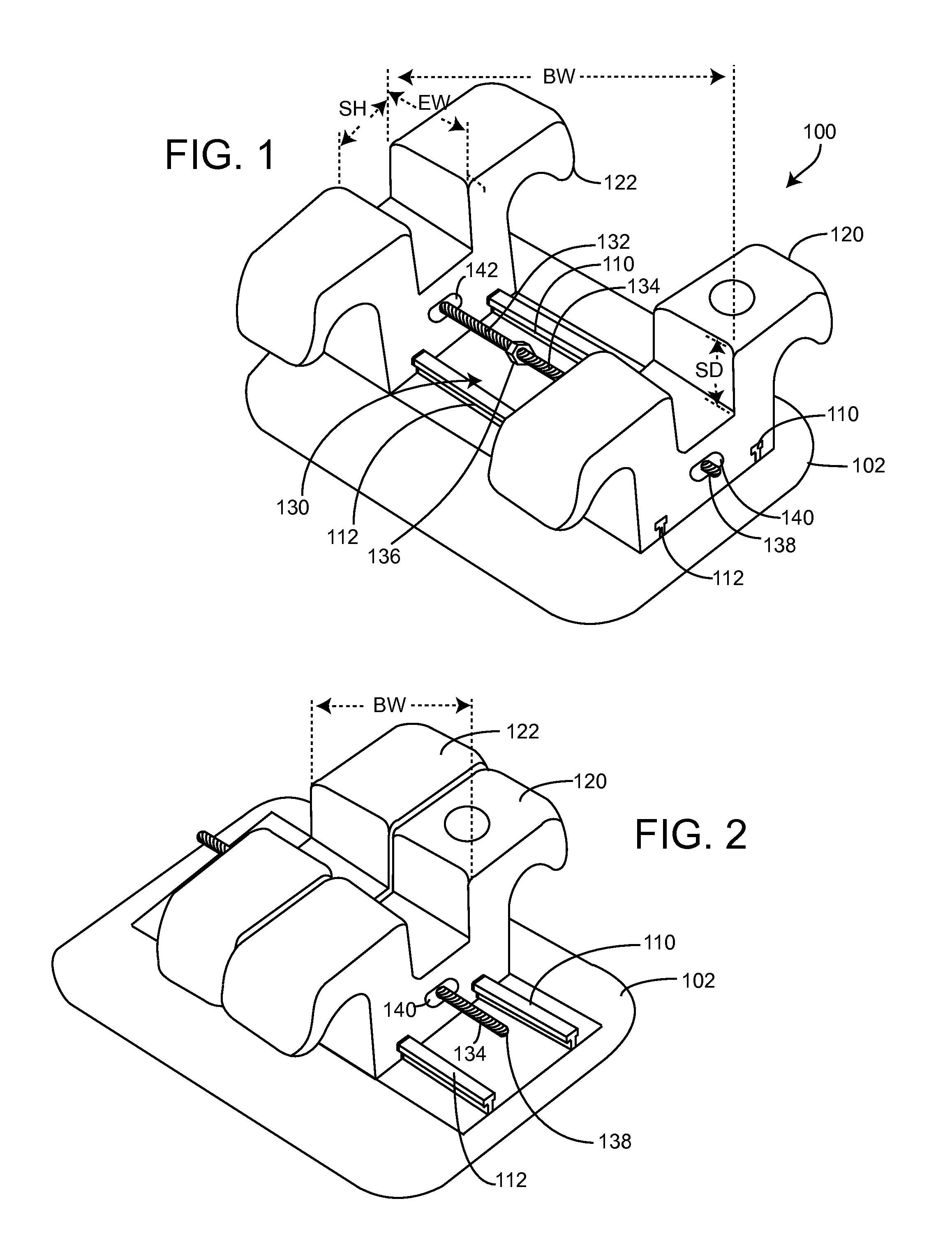 Method and system for bodily translating a tooth with a wide and adjustable width brackets