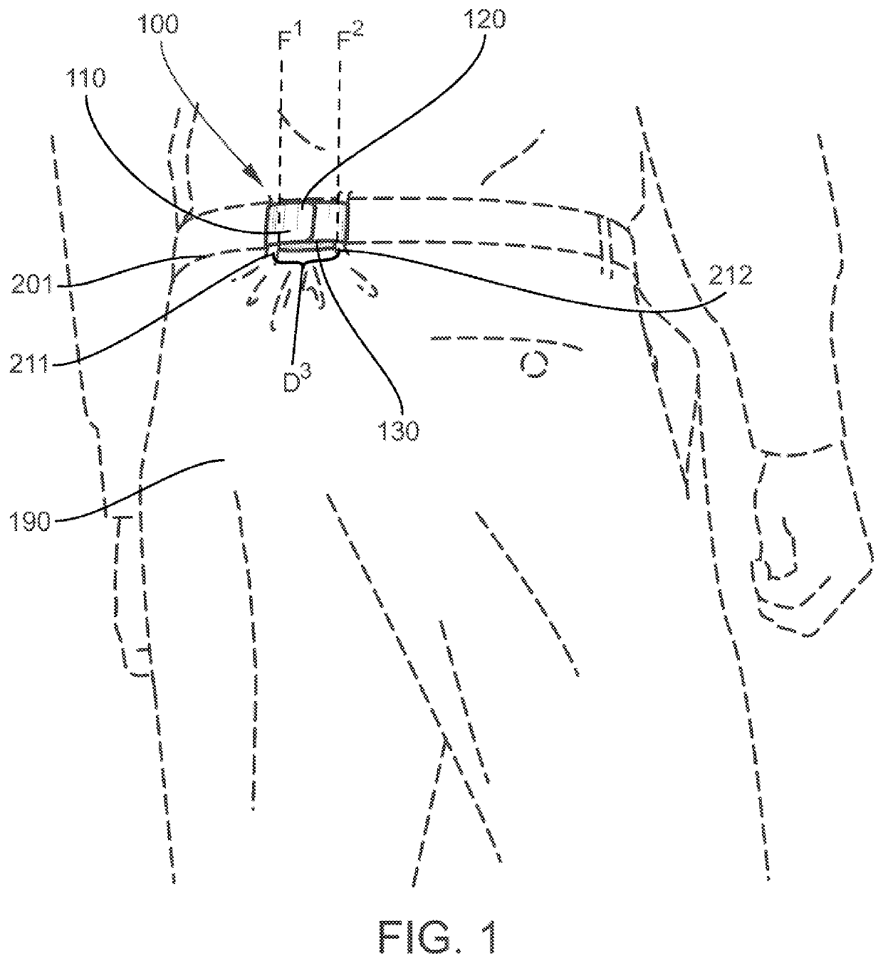 Reducing abdominal discomfort utilizing an adjustable belt loop fastening device