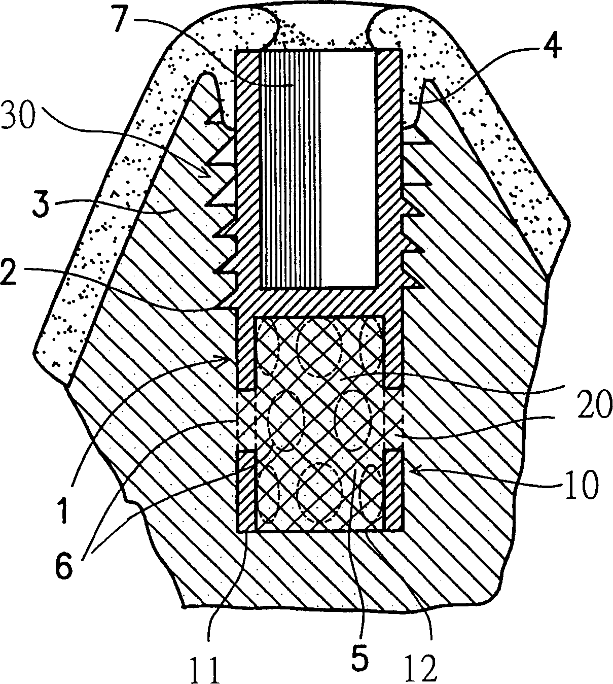 Dental implanting object containing calcium phosphate cementing agent