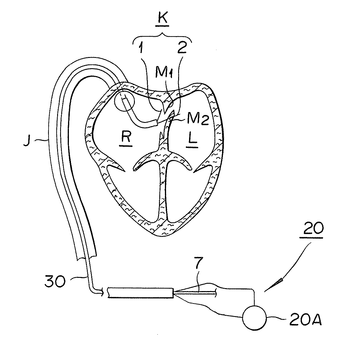 Medical device