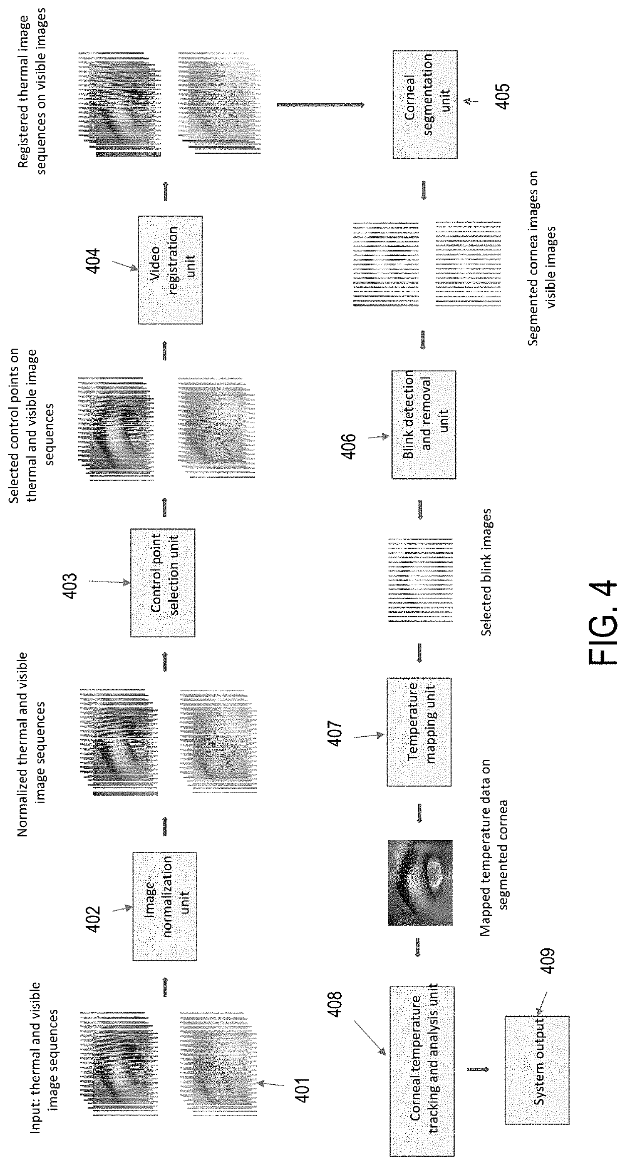System and method for imaging, segmentation, temporal and spatial tracking, and analysis of visible and infrared images of ocular surface and eye adnexa