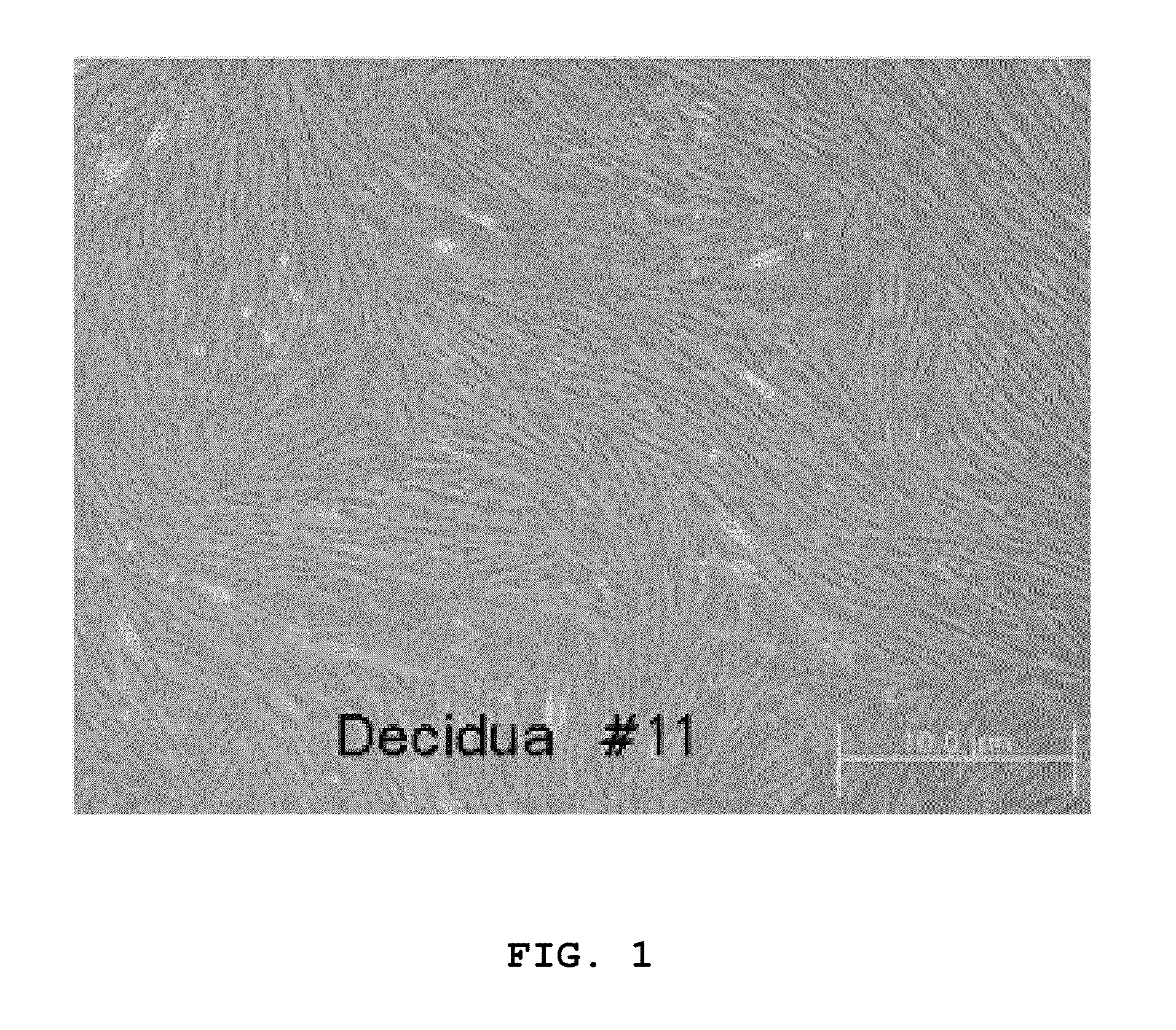 Cellular therapeutic agent for incontinence or urine comprising stem cells originated from decidua or adipose