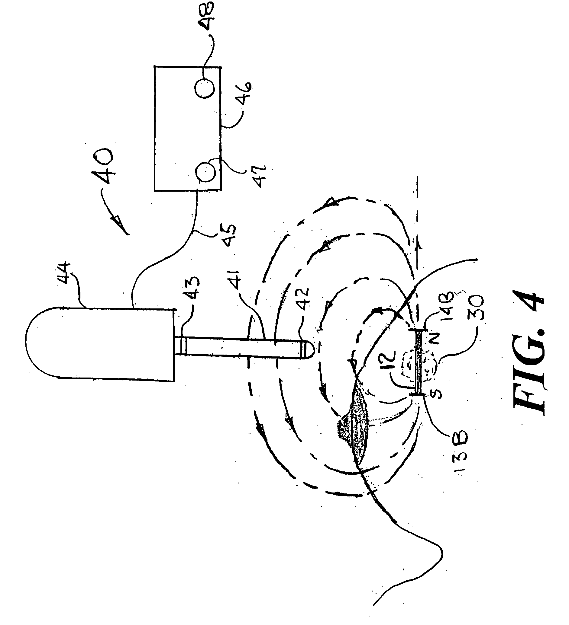 Means and method for marking tissue in a human subject