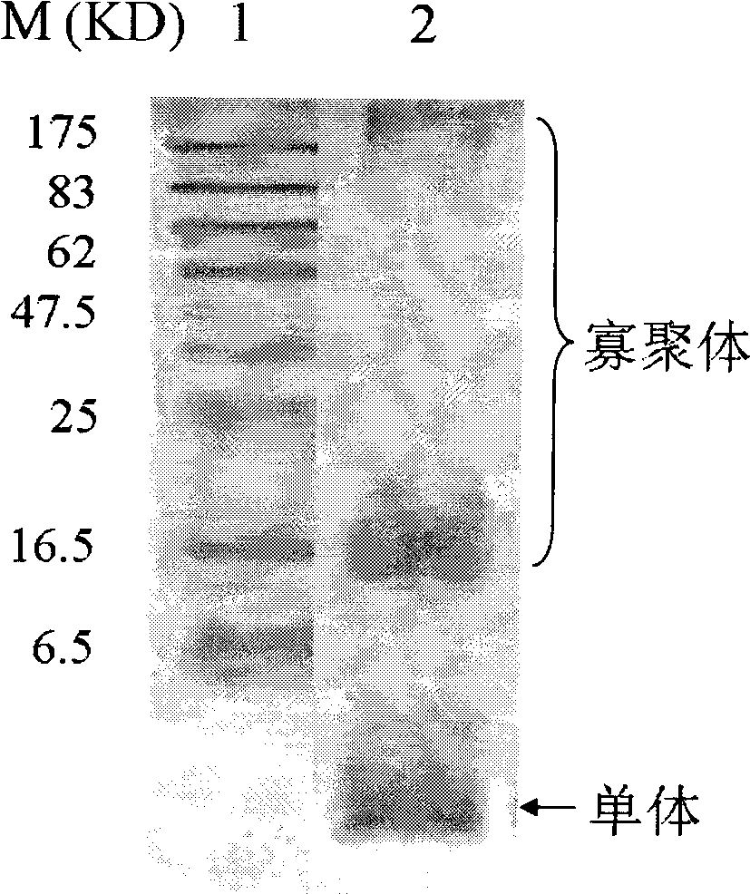 Anti-Alzheimer disease monoclonal antibody and application thereof