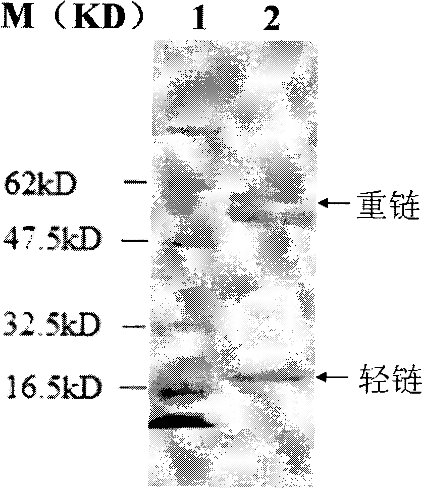 Anti-Alzheimer disease monoclonal antibody and application thereof