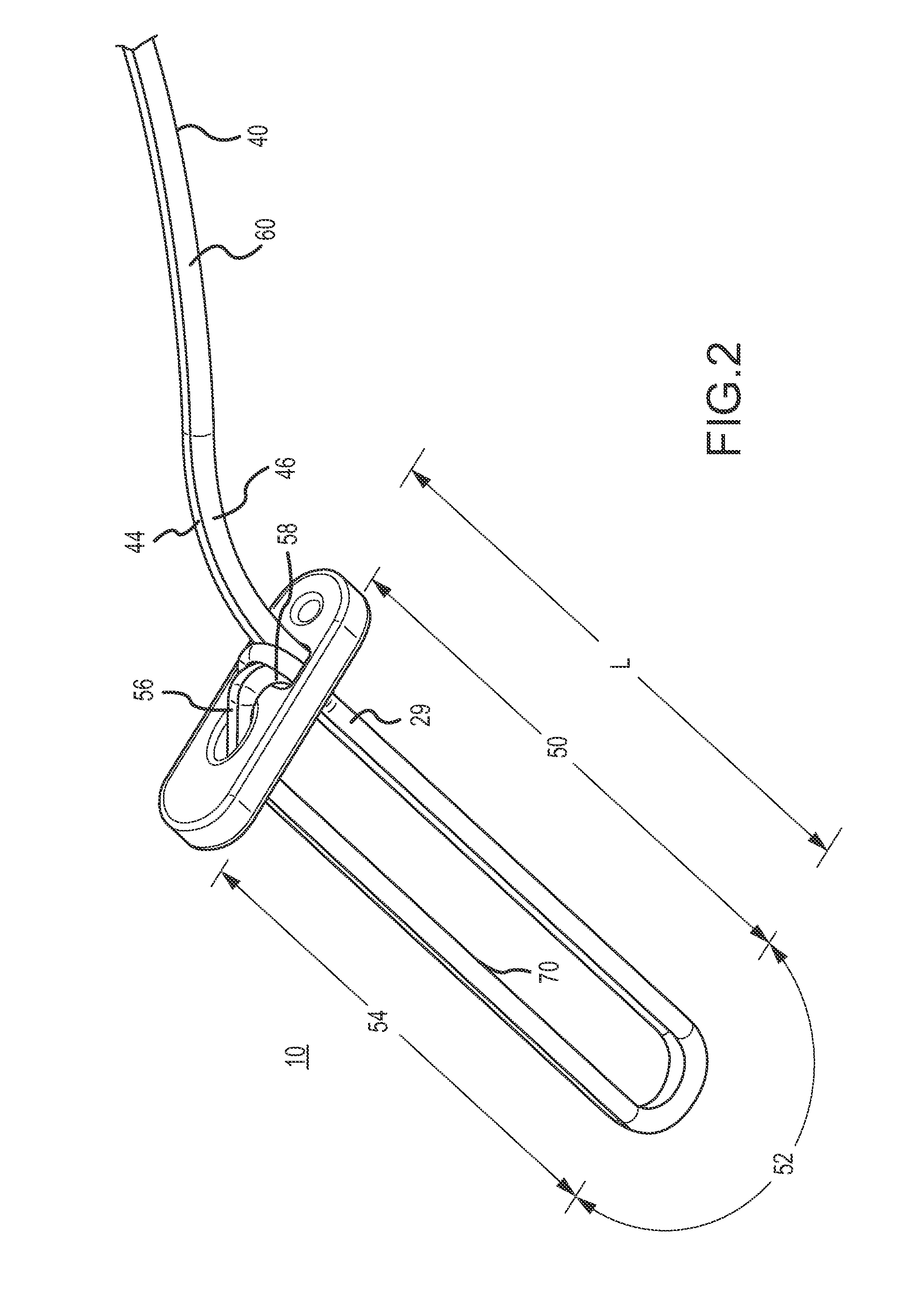 Suspensory graft fixation with adjustable loop length