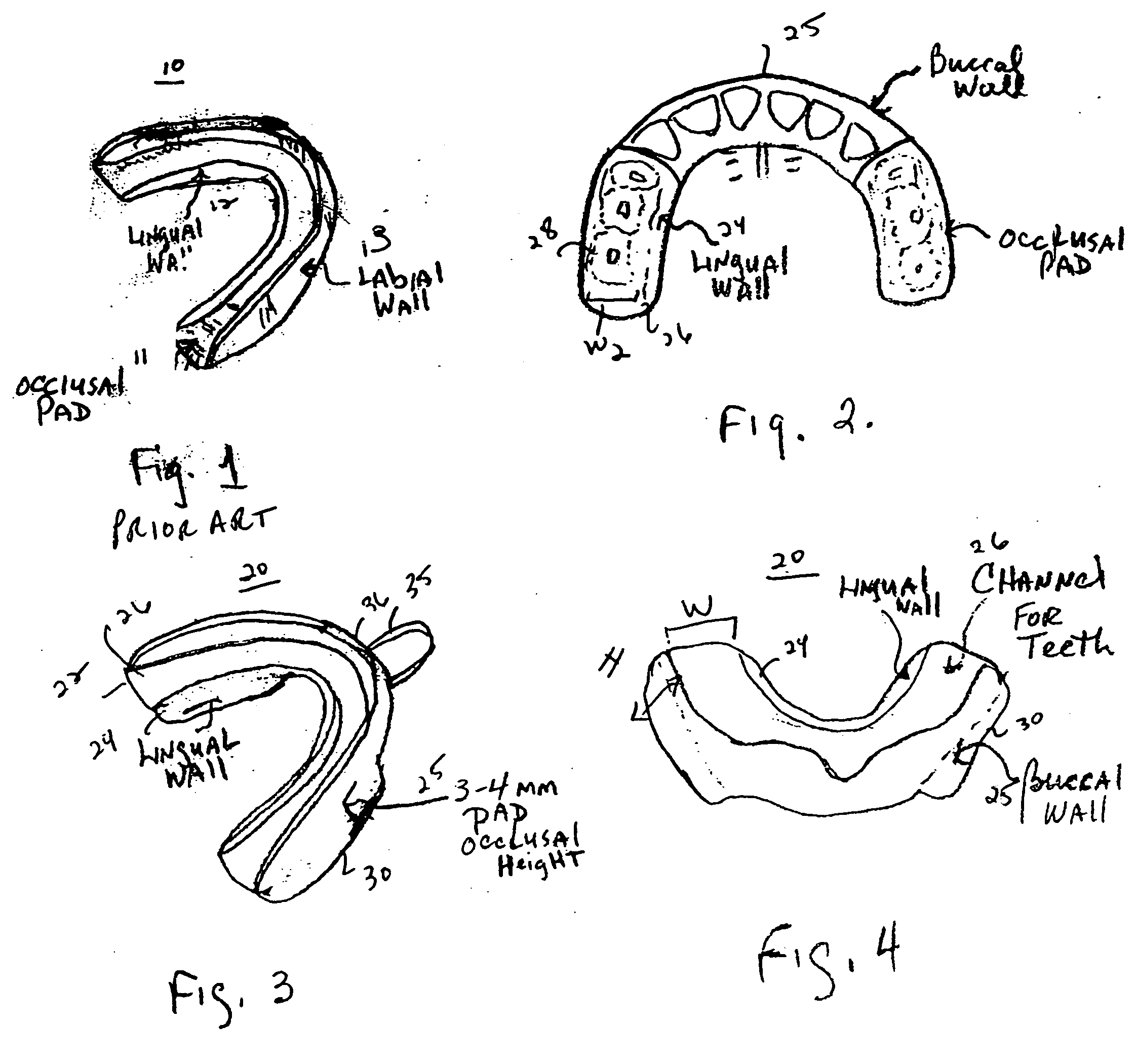 Dental appliance and mouthguard formed of polyolefin elastomer