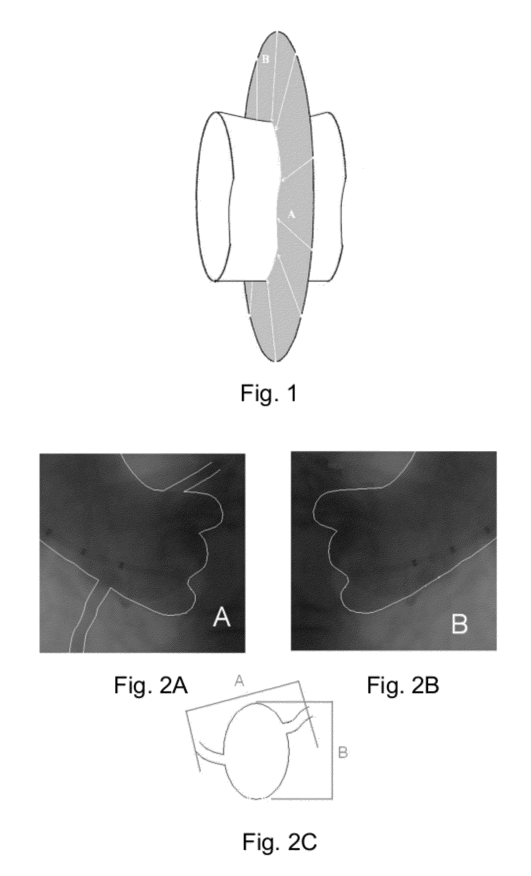 Method and Apparatus for Determining Optimal Image Viewing Direction