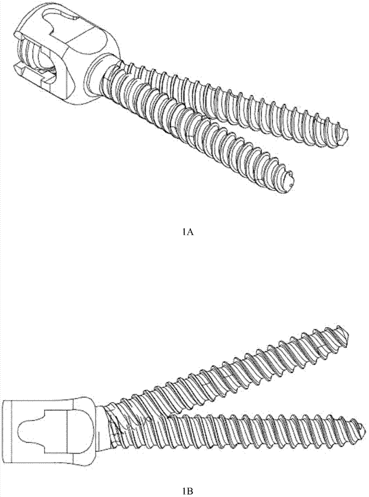 One-way automatic stretching pedicle screw and application thereof