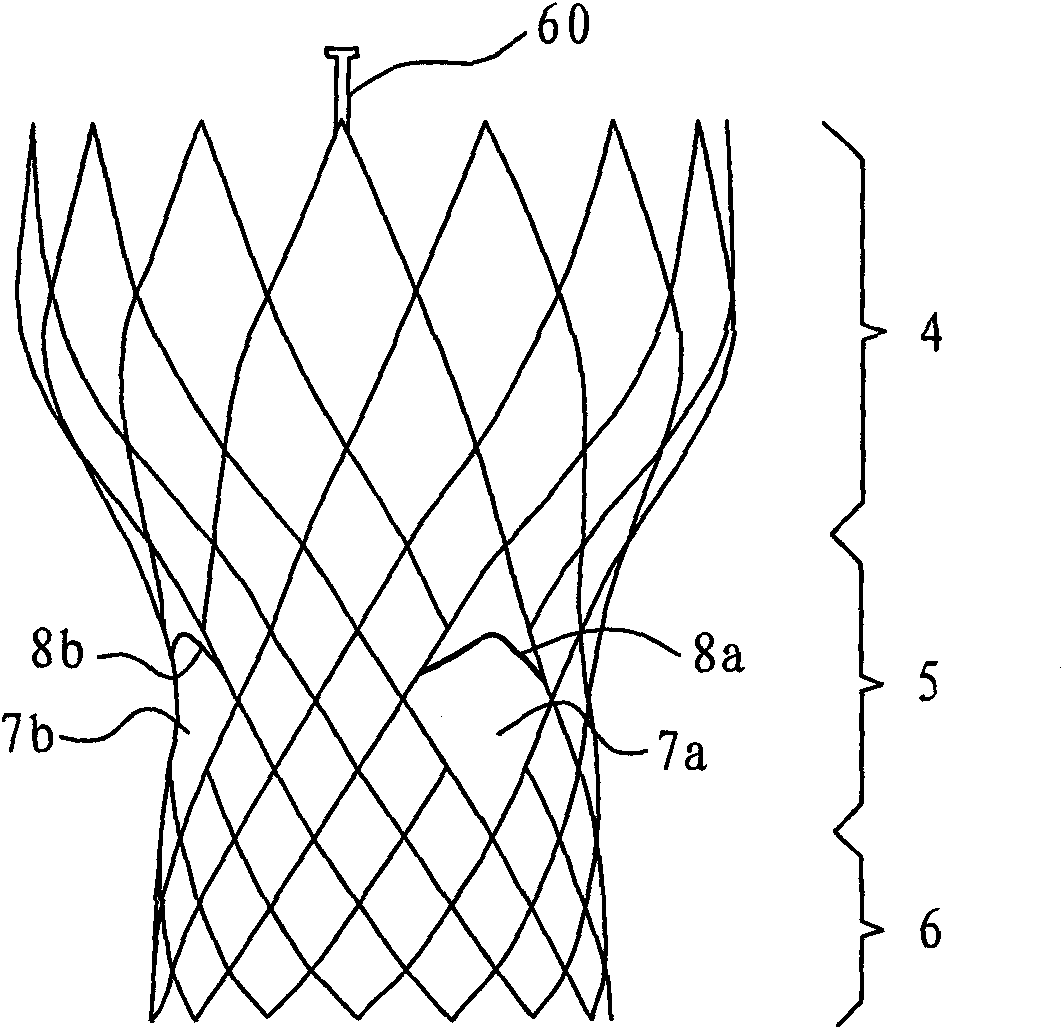 Artificial valve displacement device and stent