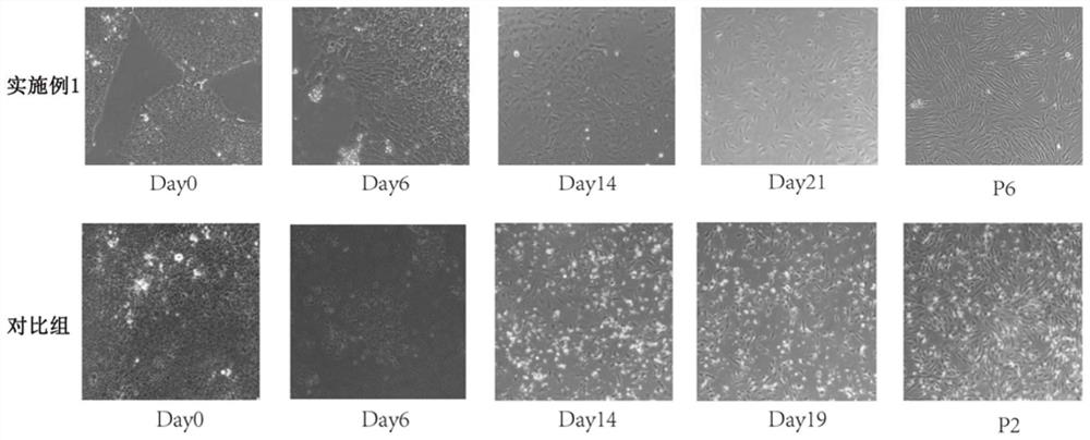 A medium combination and method for inducing pluripotent stem cells to differentiate into mesenchymal stem cells