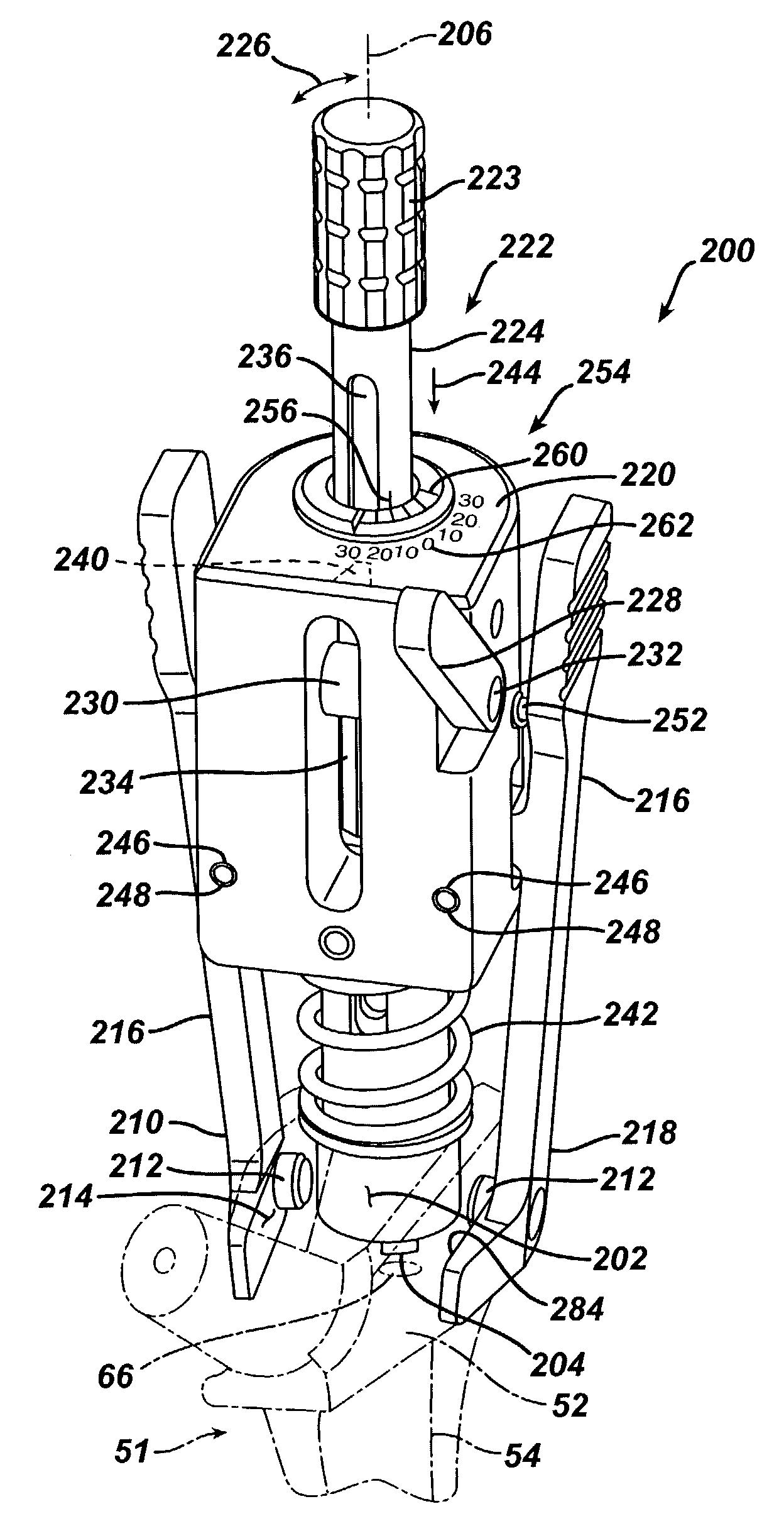Alignment device for modular implants and method