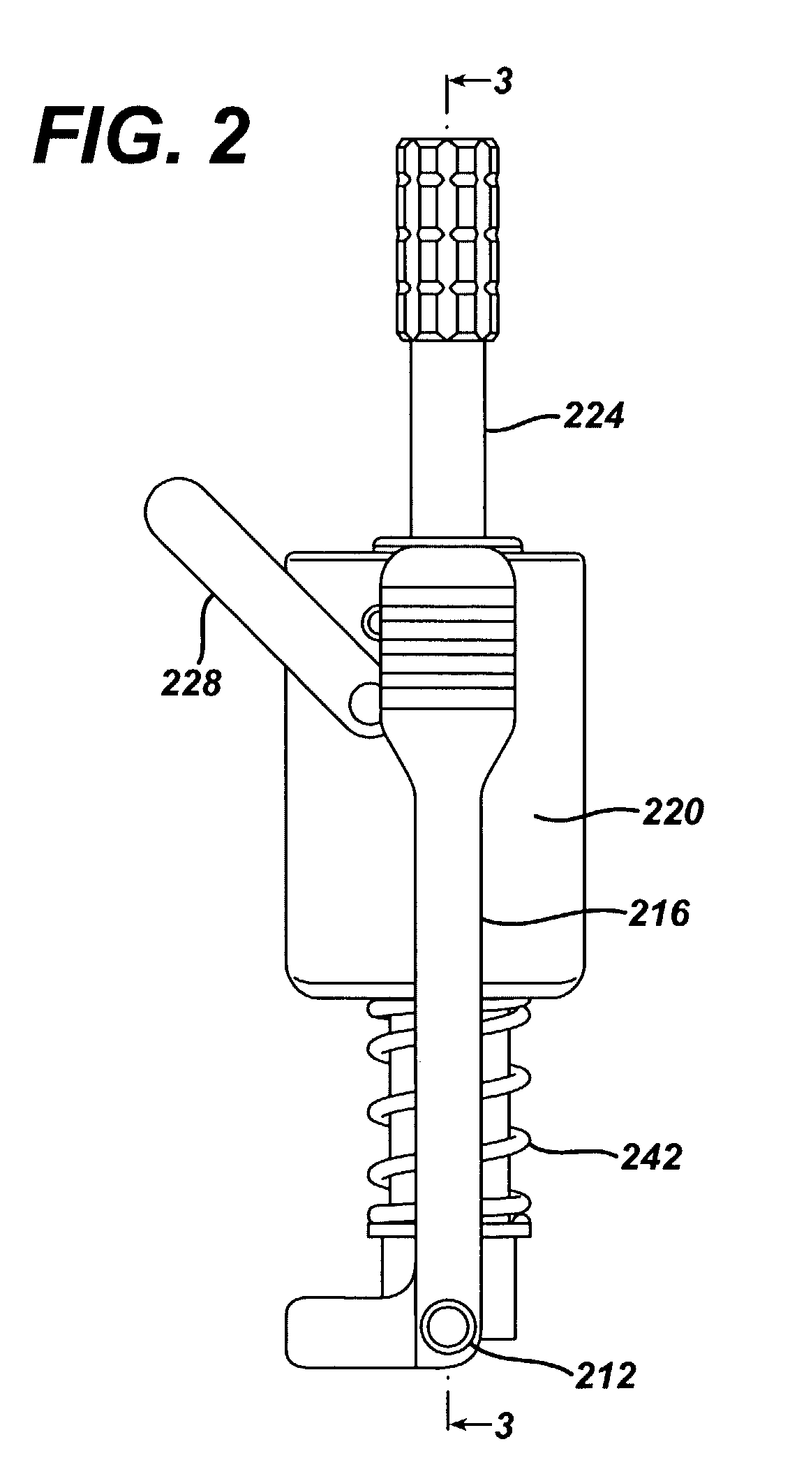 Alignment device for modular implants and method