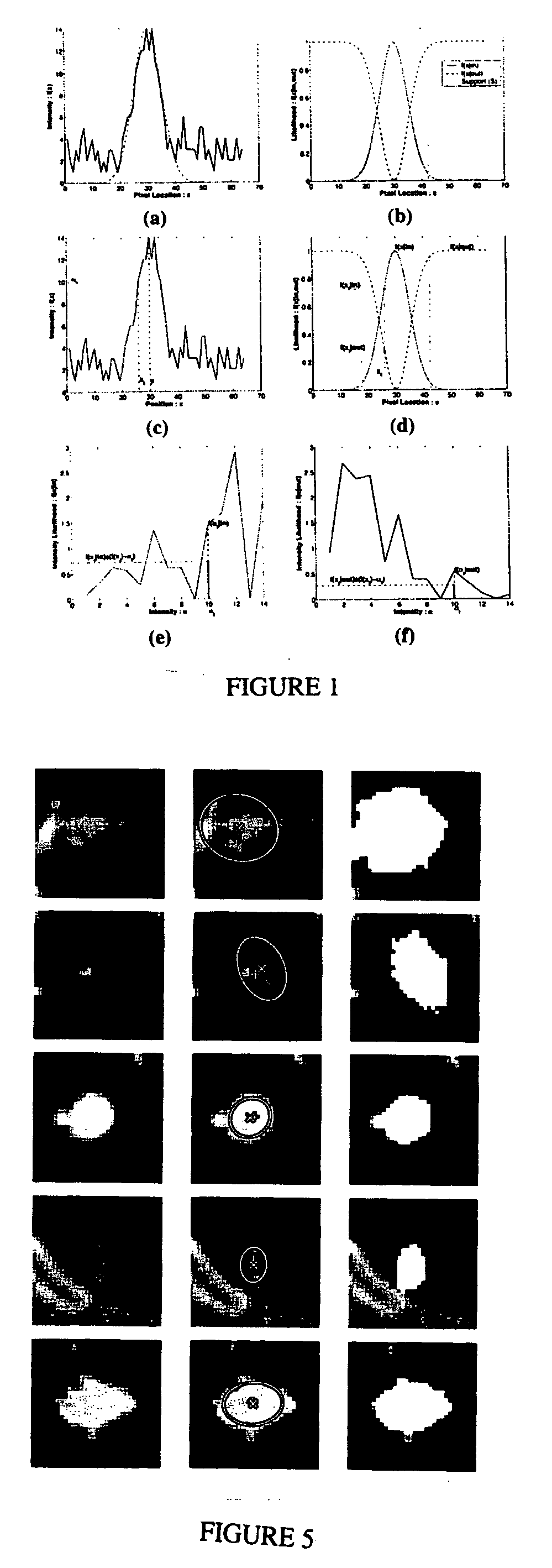 System and method for volumetric tumor segmentation using joint space-intensity likelihood ratio test