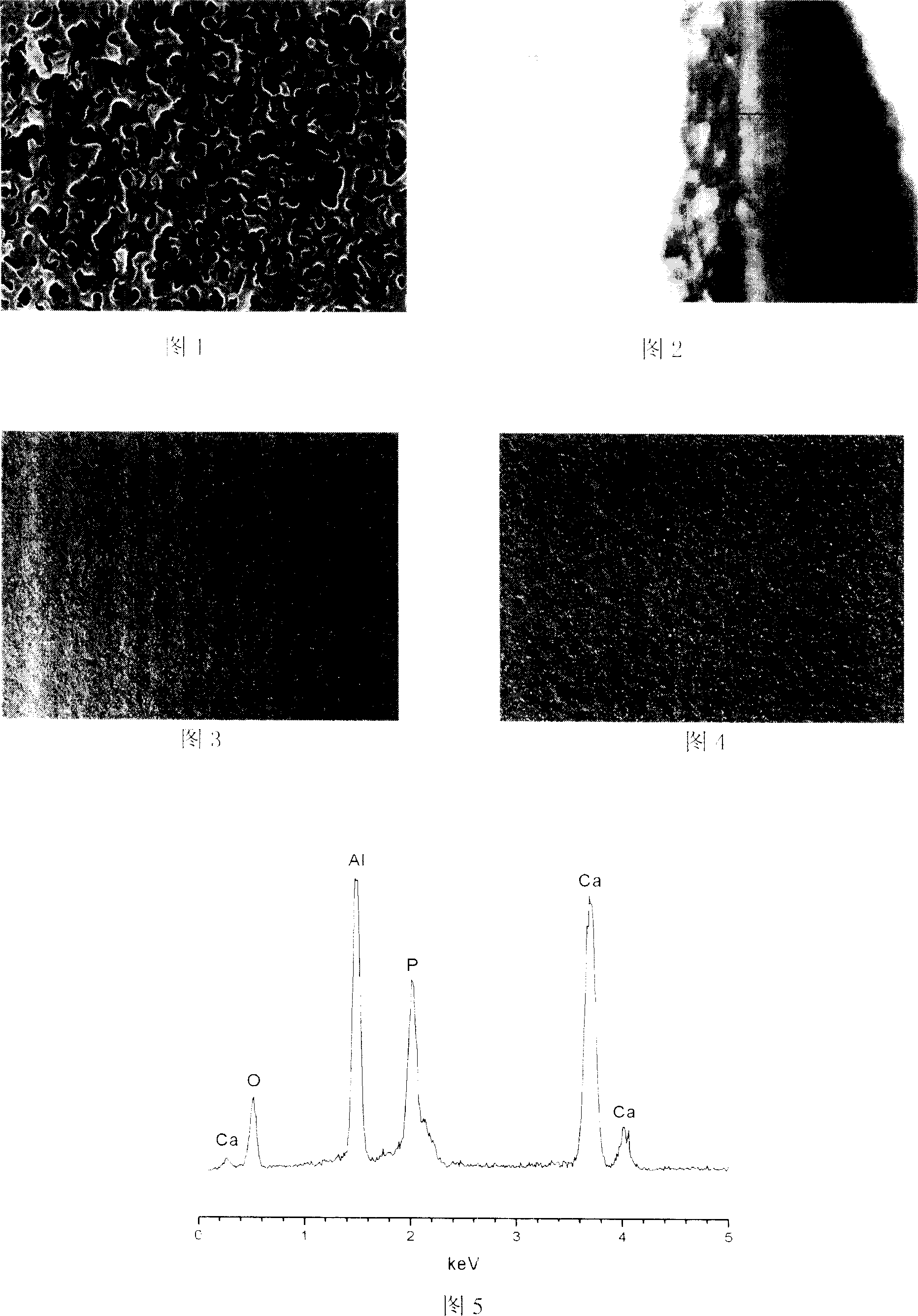 Process for preparing composite coat of hydroxy apatite and aluminum oxide