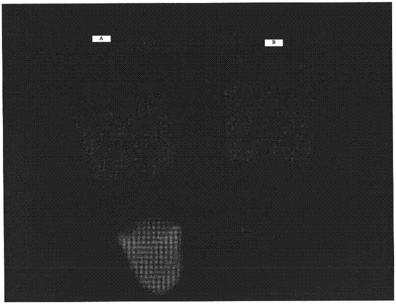 Riemerella anatipestifer LAMP detection kit and its detection method