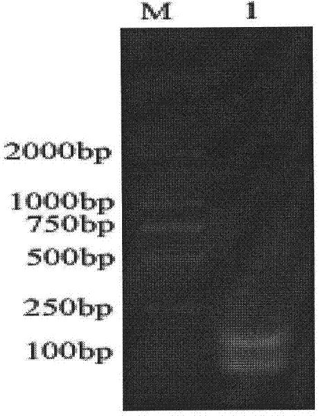 Riemerella anatipestifer LAMP detection kit and its detection method