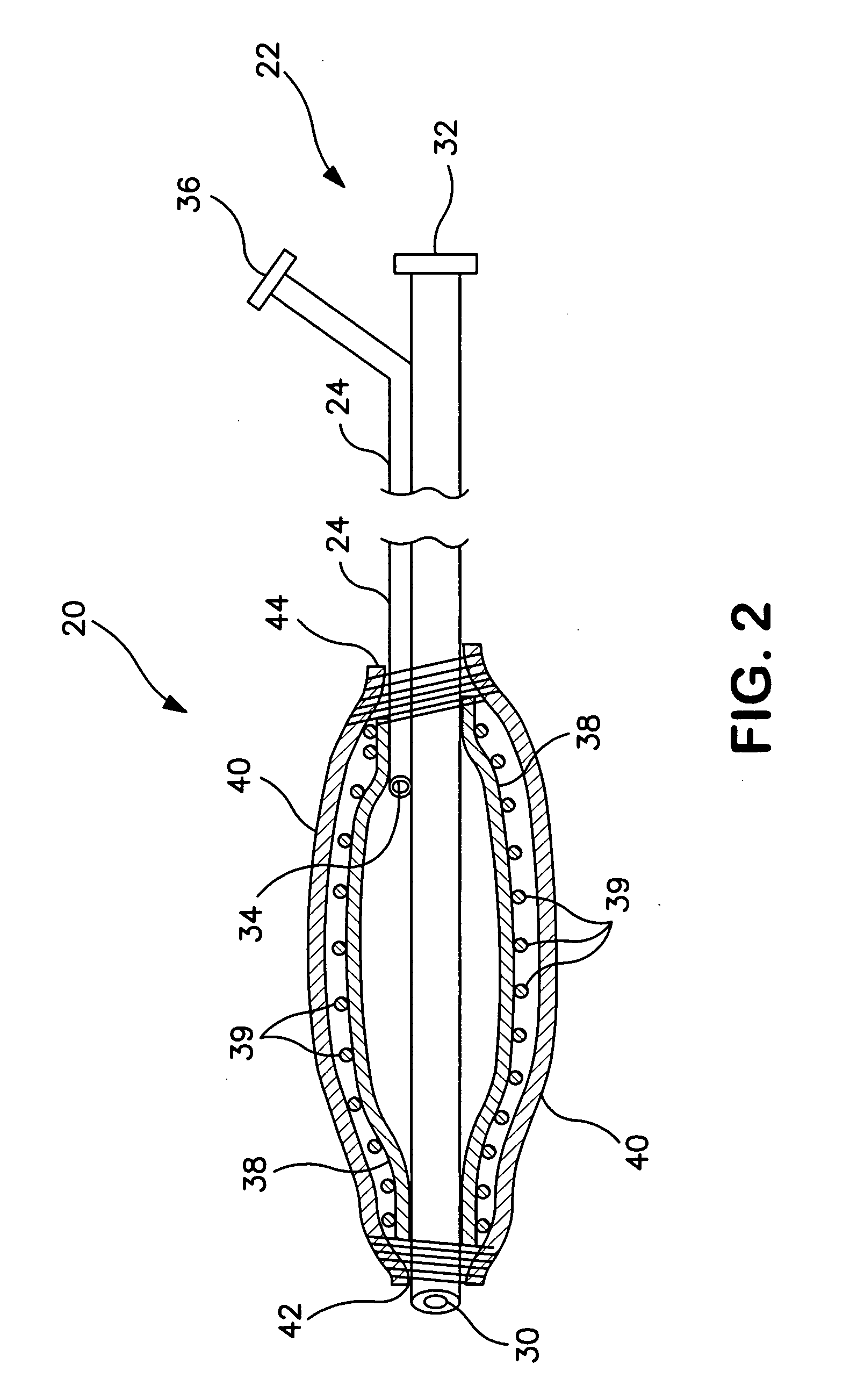 Medical balloon and method of making the same