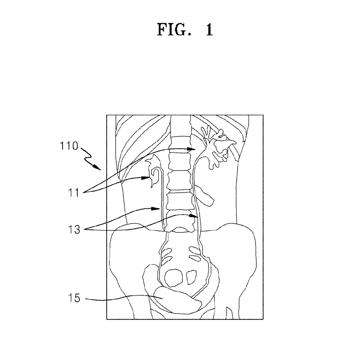 Method and apparatus for obtaining x-ray image of region of interest of object