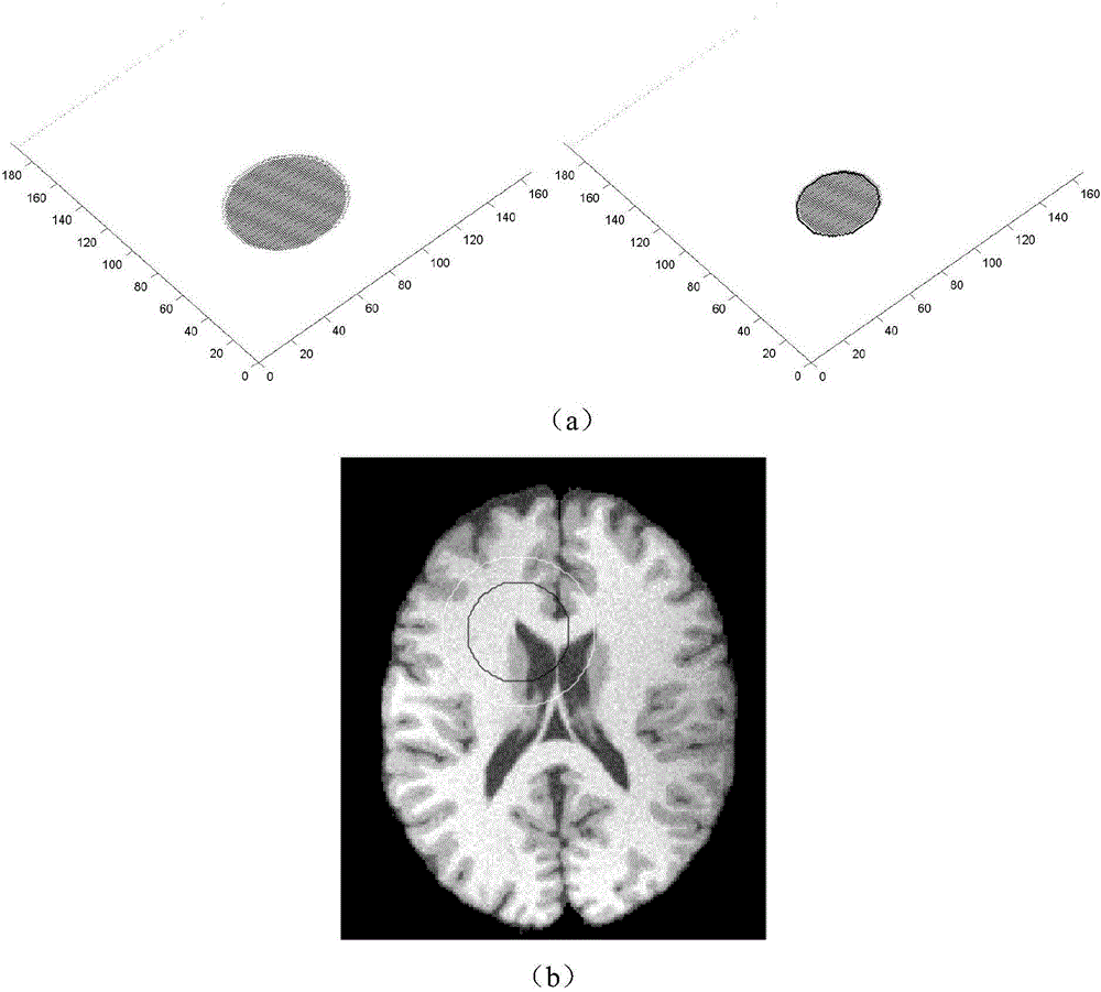 Image level set segmentation method based on local gray clustering characteristics