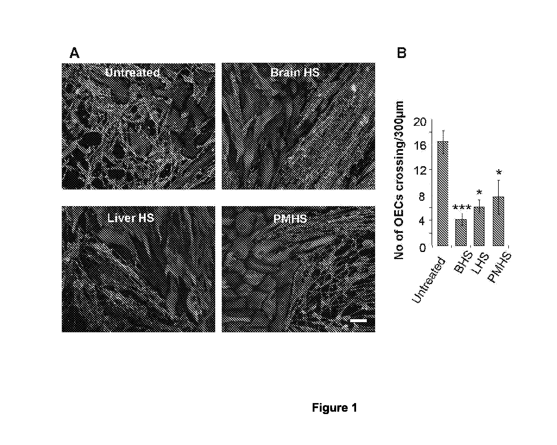 Agents for the prevention and/or treatment of central nervous system damage