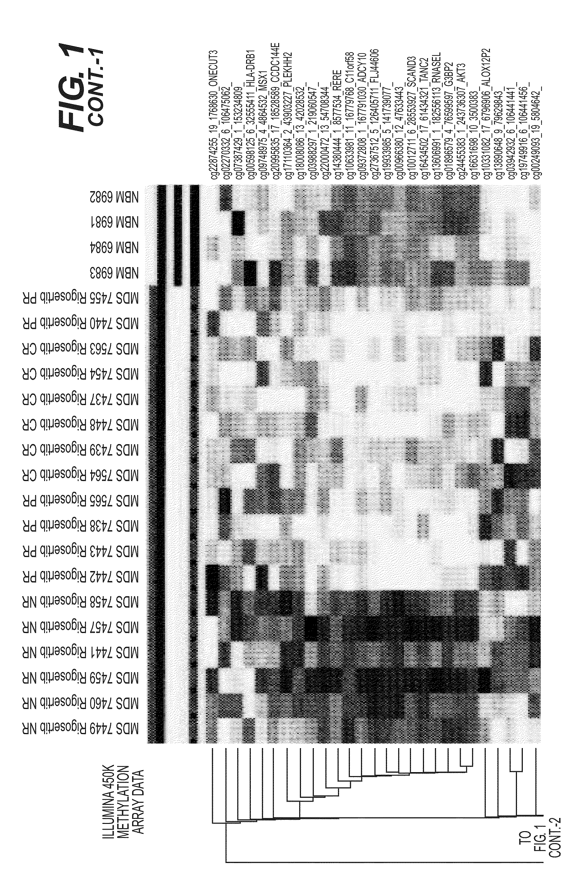 Methods and compositions for predicting therapeutic efficacy of kinase inhibitors in patients with myelodysplastic syndrome or related disorders