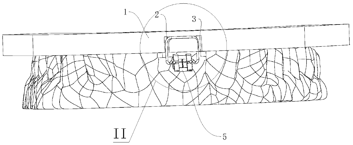 Self-adaptive indirect bracket bonding support