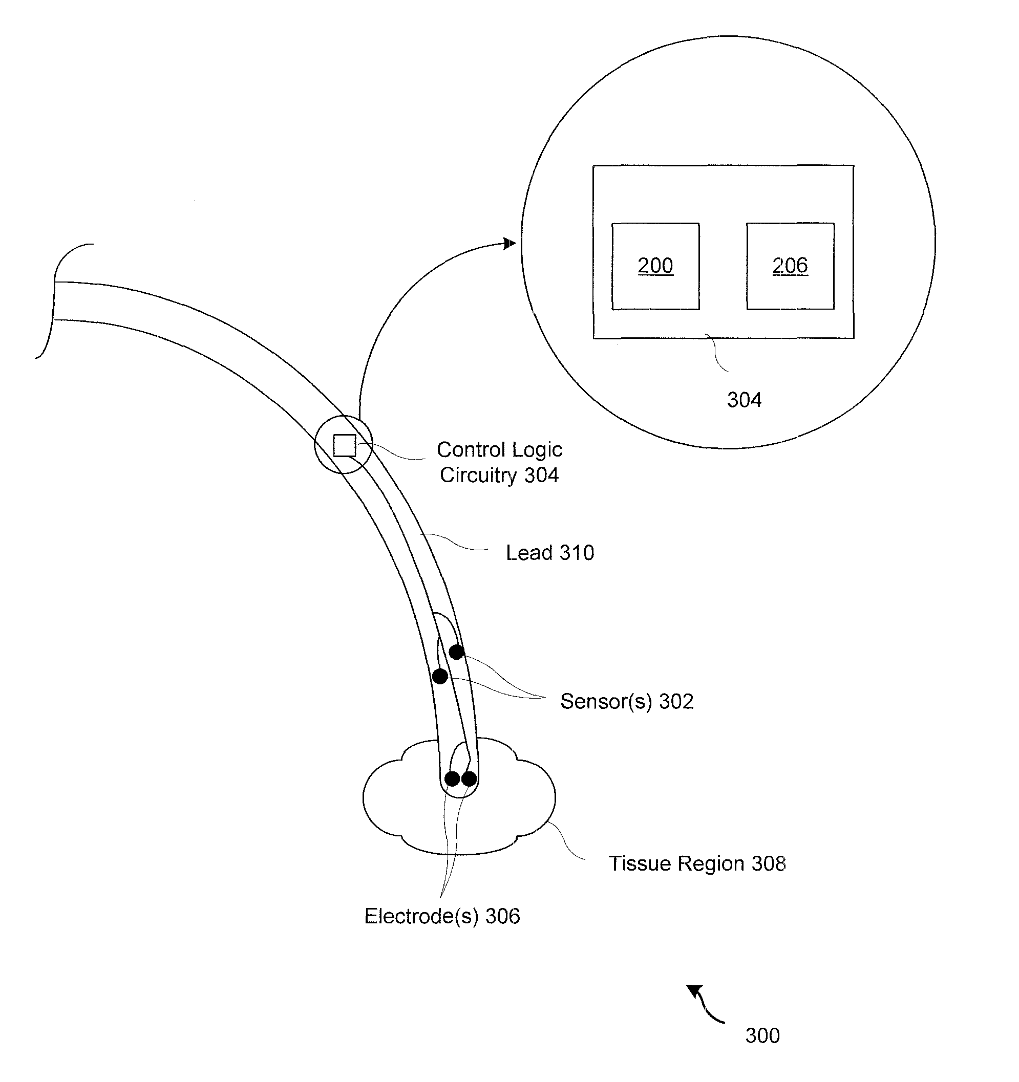 Sensing system, device, and method for therapy modulation