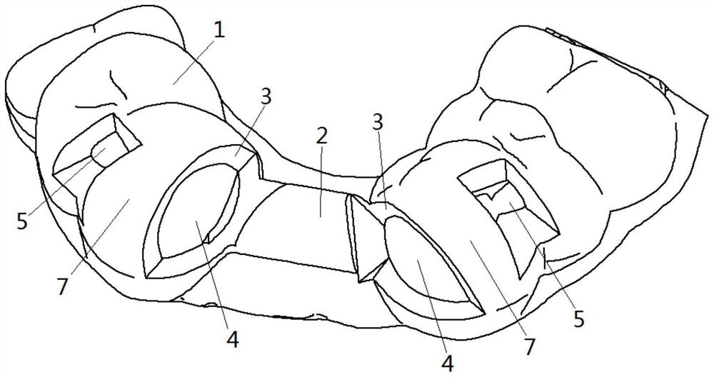 Construction method and production method of preparatory guide plate and removable partial denture bracket model