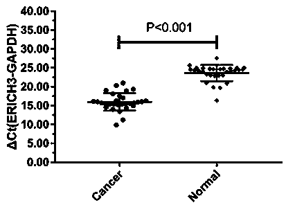 Application of UGT3A2 gene and protein coded by UGT3A2 gene in auxiliary diagnosis of upper gastrointestinal tumors