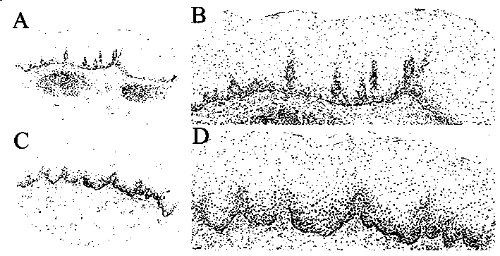 Application of UGT3A2 gene and protein coded by UGT3A2 gene in auxiliary diagnosis of upper gastrointestinal tumors